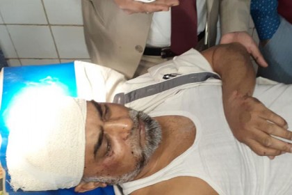ময়মনসিংহ বিভাগীয় কমিশনার মোস্তাফিজুরসহ আহত ৩