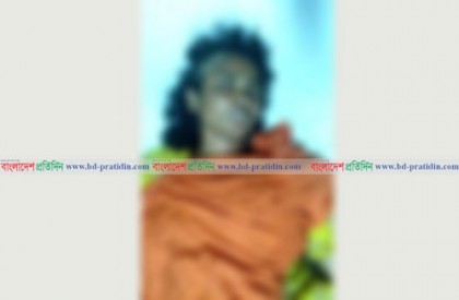 স্ত্রীর মাথার চুল কেটে আগুন দিল স্বামী 