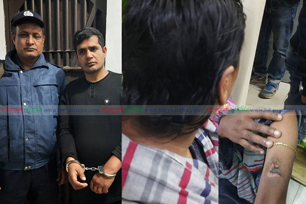 চুল কেটে নারীর শরীরে গরম লোহার ছ্যাঁকা দিল ১৬ মামলার আসামি