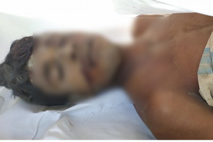 ধান ক্ষেত পাহারা দিতে গিয়ে দুর্বৃত্তের পিটুনিতে কৃষক নিহত
