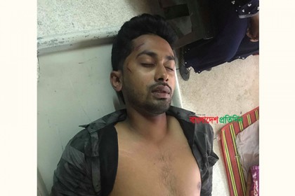 শেকৃবি'তে ছাত্রলীগ নেতাকে রুমে আটকে মারধরের অভিযোগ