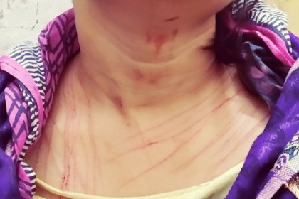 জমির বিরোধে গৃহিনীর ওপর এ কেমন বর্বরতা