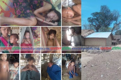 লামায় অজ্ঞাত রোগে আক্রান্ত ৮ পরিবার, এক শিশুর মৃত্যু 