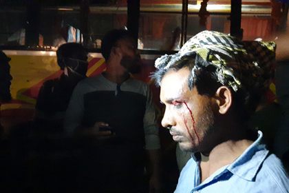 ব্রাহ্মণবাড়িয়ায় বাসে দুর্বৃত্তদের হামলা, আহত ১০