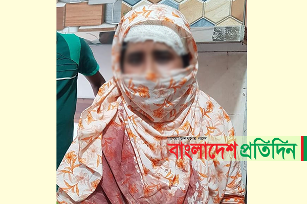 বিদেশফেরতের তথ্য পুলিশকে দেওয়ায় গৃহবধূর উপর হামলা!
