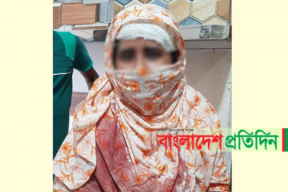 বিদেশফেরতের তথ্য পুলিশকে দেওয়ায় গৃহবধূর উপর হামলা!