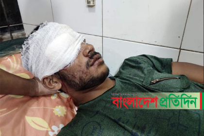 মার্বেল খেলা নিয়ে সংঘর্ষে চোখ হারালেন তরুণ