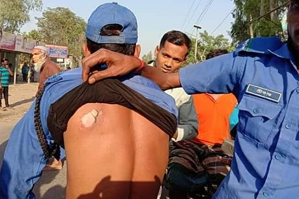 সিংড়ায় গ্রাম পুলিশের গায়ে গরম পানি ঢেলে দিল চা দোকানদার