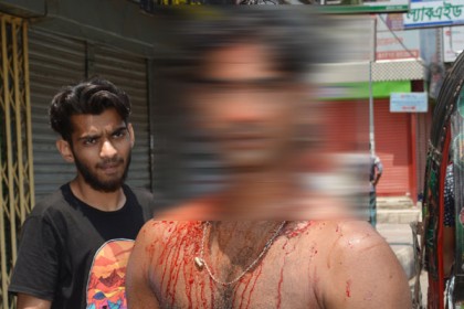 বরিশালে চা দোকানিকে প্রকাশ্যে কুপিয়ে আহত