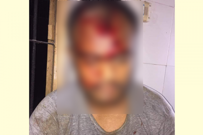 জুয়া খেলায় বাধা, স্বেচ্ছাসেবক লীগ নেতাকে কুপিয়ে জখম 