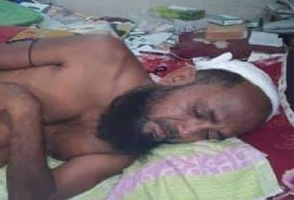 মারধর করায় ইউপি চেয়ারম্যানের মাথা ফাটালেন পথচারীরা, পুলিশের গুলি!