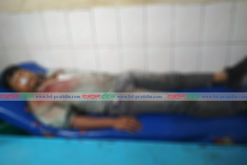 নরসিংদীতে এসএ টিভির সাংবাদিকের উপর চেয়ারম্যানের হামলা