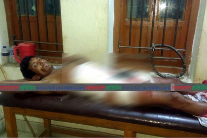 জামালপুরে জমি নিয়ে সংঘর্ষে নিহত ১, গুলিবিদ্ধসহ আহত ২