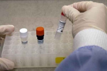 সিরাজগঞ্জে গণমাধ্যম কর্মীদের করোনা টেস্ট