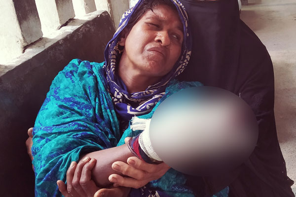 জমি নিয়ে বিরোধে আঙুল হারালেন নারী, সংঘর্ষে আহত ৯