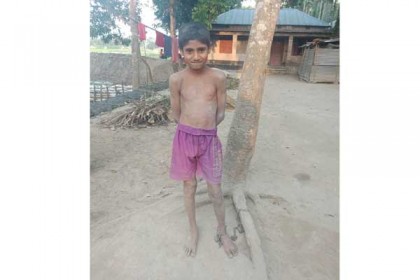টাইফয়েডে মানসিক ভারসাম্য হারানো শিশুর শিকলে বাঁধা জীবন