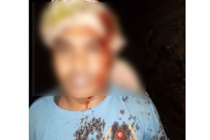 টেকনাফে ঢাবি ছাত্রকে কুপিয়ে হত্যার চেষ্টা