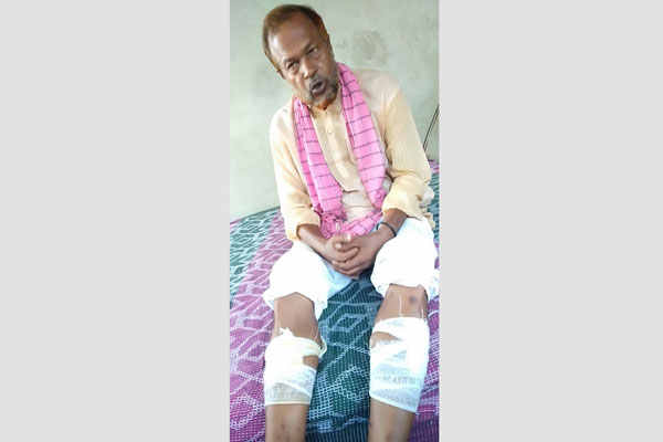 ধামরাইয়ে চেয়ারম্যান ও সাবেক মেম্বারের মধ্যে হাতাহাতি, আহত ৪