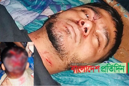 ঈদের দাওয়াতে ডেকে এনে বন্ধুকে কোপাল বন্ধু!