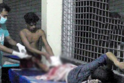 মামাতো ভাইয়ের পা কেটে নিল ফুফাতো ভাই!