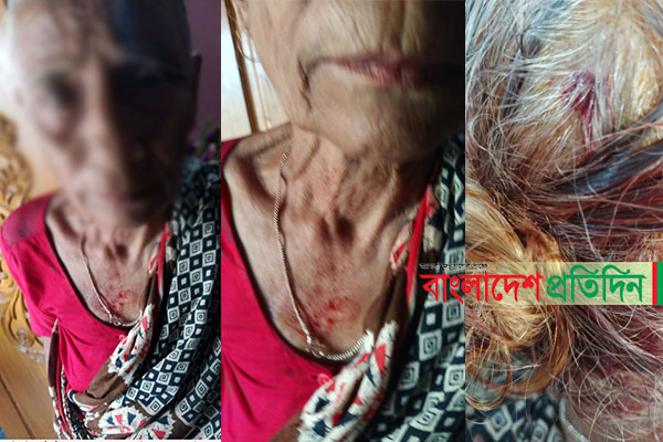 কোটি টাকার সম্পত্তি লিখে নিয়ে বৃদ্ধা মাকে বের করে দিল সন্তান!