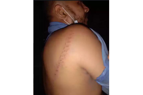 কুমিল্লার মহাসড়কে সক্রিয় রড নিক্ষেপ চক্র, মারধর করে ছিনতাই