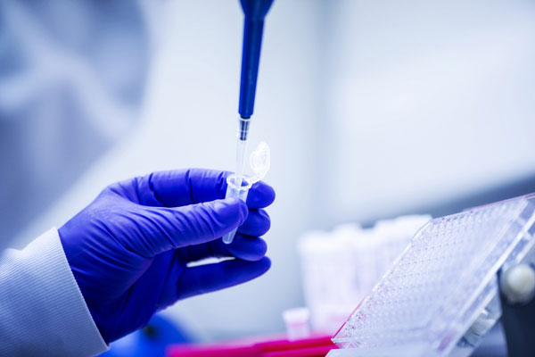 যশোরে নমুনা পরীক্ষার ১০০তম দিন; মোট করোনা আক্রান্ত ২৮২

