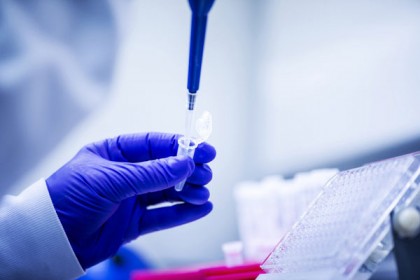 যশোরে নমুনা পরীক্ষার ১০০তম দিন; মোট করোনা আক্রান্ত ২৮২

