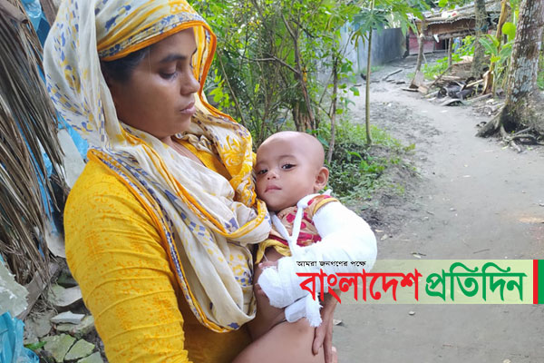 সরকারি হাসপাতালে শিশুর ভাঙা হাত ব্যান্ডেজে ৪ হাজার টাকা দাবি!