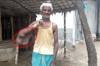 ২২ বছর ধরে অজ্ঞাত রোগে ভুগছেন কালু