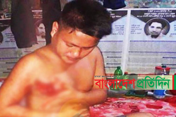 রাঙামাটিতে জেএসএস-সংস্কারপন্থীর বন্দুকযুদ্ধ, আহত ১