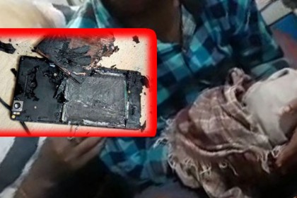 মোবাইলের ব্যাটারি দিয়ে আলো জ্বালাতে গিয়ে হাত গেল কিশোরের