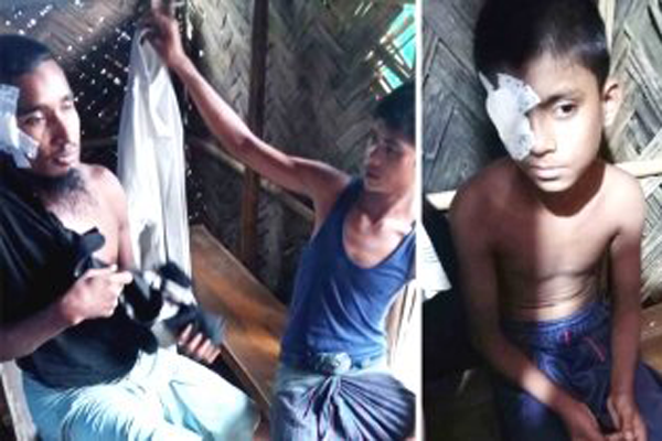 রোহিঙ্গা ক্যাম্পে আধিপত্য বিস্তারকে কেন্দ্র করে গোলাগুলিতে আহত ৪