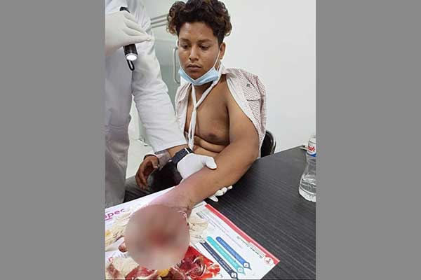 কালিয়াকৈরে স্কুলছাত্রের আঙ্গুল কেটে ফেললো মাদক ব্যবসায়ীরা