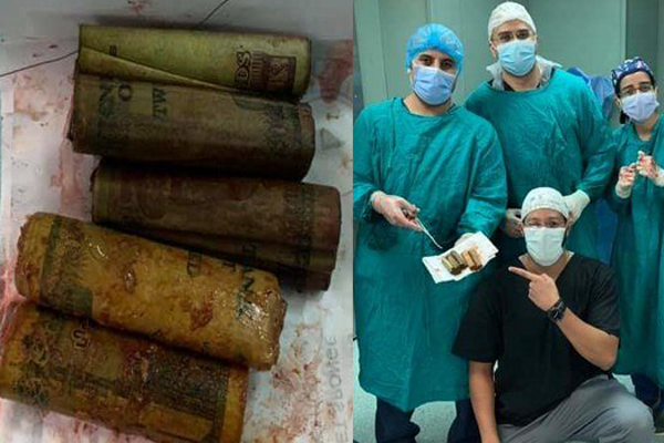 পেট থেকে সাড়ে ৬ হাজার মিশরীয় পাউন্ড উদ্ধার