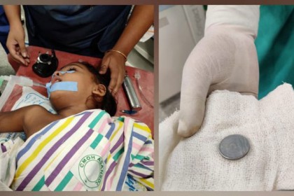 খেলতে খেলতেই ৫ টাকার কয়েন গলায় আটকে শ্বাসরুদ্ধ কিশোর, অতঃপর…