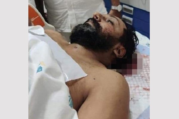 ভারতে বিজেপি নেতাকে প্রকাশ্যে গুলি করে হত্যা