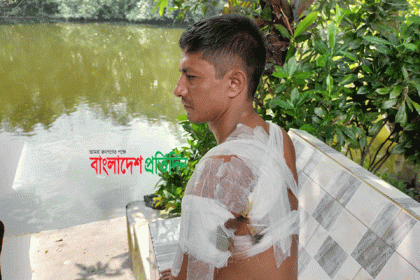কুমিল্লায় ভোট কেন্দ্রের বাইরে সংঘর্ষে আহত ১০