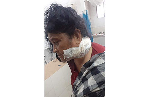 কুমিল্লায় নারী কাউন্সিলরের গলায় কাটারের আঘাত 