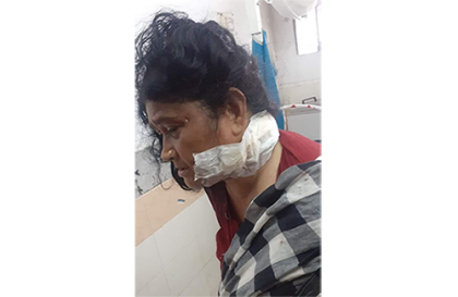 কুমিল্লায় নারী কাউন্সিলরের গলায় কাটারের আঘাত 