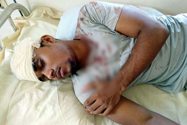 রাজাপুরে কলেজ ছাত্রের ওপর দুর্বৃত্তের হামলা