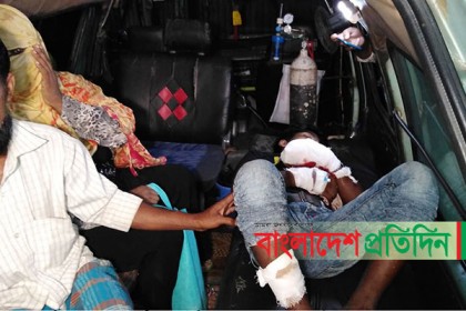 ম্যাচের কাঠি দিয়ে বোমা বানানোর চেষ্টা, বিস্ফোরণে যুবক দগ্ধ