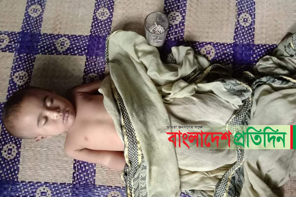 নোয়াখালীতে মাথায় নারিকেল পড়ে শিশুর মৃত্যু