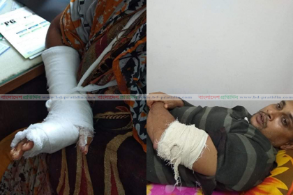 শিবপুরে ডাকাত দলের হামলায় মুক্তিযোদ্ধাসহ তিনজন আহত