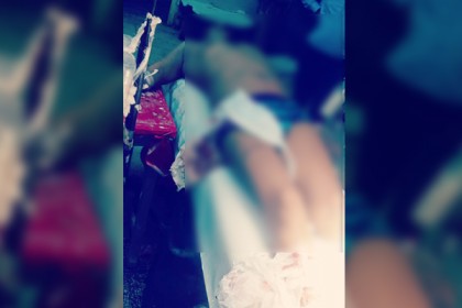 বরগুনায় যুবলীগ নেতার পায়ের রগ কেটে দিলো দুর্বৃত্তরা