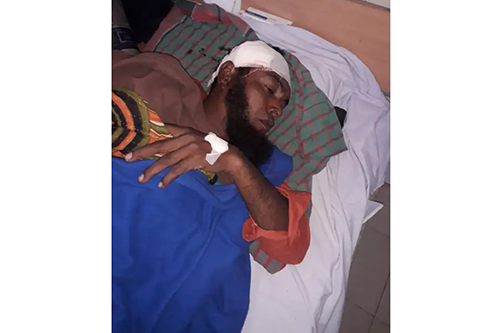 ফরিদপুরে ইউপি নির্বাচনকে কেন্দ্র করে আওয়ামী লীগ সভাপতি উপর হামলা, আহত ১৫