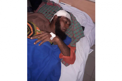 ফরিদপুরে ইউপি নির্বাচনকে কেন্দ্র করে আওয়ামী লীগ সভাপতি উপর হামলা, আহত ১৫