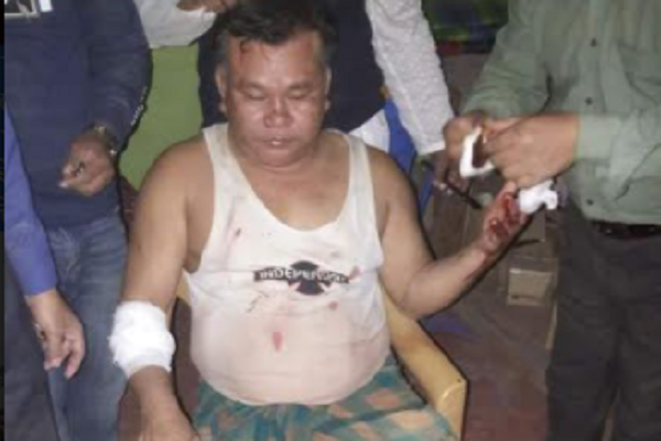 টেকনাফে স্বামীর ছুরিকাঘাতে স্ত্রী নিহত, ঘাতক স্বামী আটক
