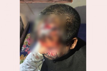 নোয়াখালীতে আওয়ামী লীগের দুই পক্ষের সংঘর্ষ, চেয়ারম্যানসহ আহত ৮