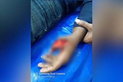 নাসিরনগরে স্বেচ্ছাসেবী সংগঠনের সদস্যরা ডাকাতির কবলে, আহত ১